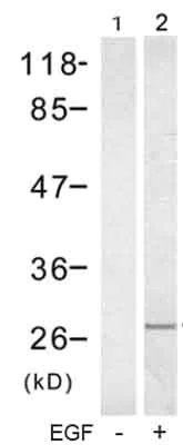 Western blot - Anti-Rac1 antibody (AB129758)