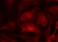 Immunocytochemistry/ Immunofluorescence - Anti-Rac1 antibody (AB97732)