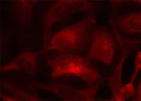 Immunocytochemistry/ Immunofluorescence - Anti-Rac1 antibody (AB97732)