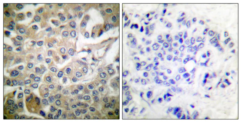 Immunohistochemistry (Formalin/PFA-fixed paraffin-embedded sections) - Anti-Rac1 antibody (AB97732)