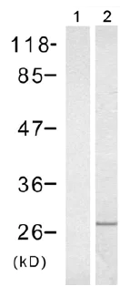 Western blot - Anti-Rac1 antibody (AB97732)