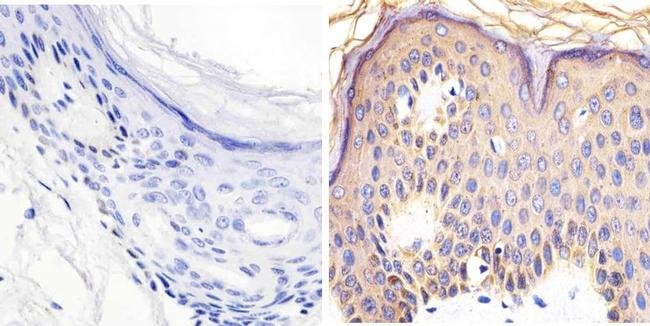 Immunohistochemistry (Formalin/PFA-fixed paraffin-embedded sections) - Anti-RAC1 + Cdc42 (phospho S71) antibody (AB5482)