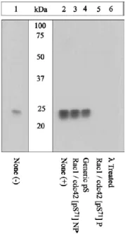 Western blot - Anti-RAC1 + Cdc42 (phospho S71) antibody (AB5482)