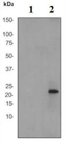 Western blot - Anti-RAC1 + Cdc42 (phospho S71) antibody [EP221Y] (AB76535)