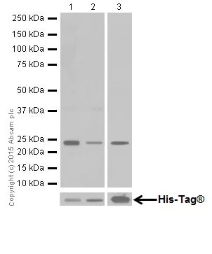 Western blot - Anti-Rac1 + Rac2 + Rac3 antibody [EPR18631] (AB180683)