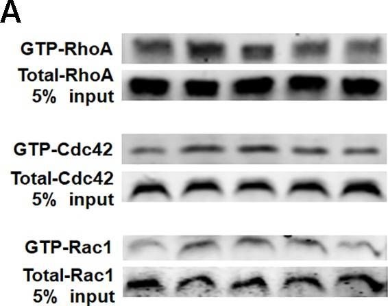 Western blot - Anti-Rac1 + Rac2 + Rac3 antibody [EPR18631] (AB180683), expandable thumbnail