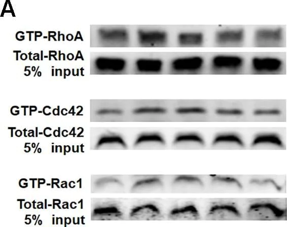 Western blot - Anti-Rac1 + Rac2 + Rac3 antibody [EPR18631] (AB180683)