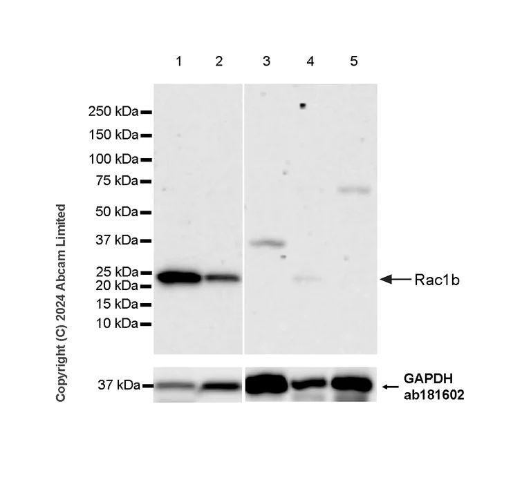 Western blot - Anti-Rac1b antibody [EPR28989-13] (AB322141)