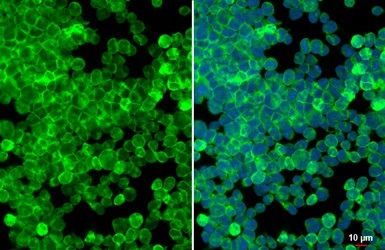 Immunocytochemistry/ Immunofluorescence - Anti-RAC2 antibody (AB154711)