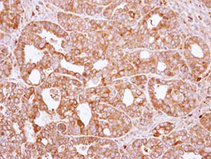 Immunohistochemistry (Formalin/PFA-fixed paraffin-embedded sections) - Anti-RAC2 antibody (AB154711), expandable thumbnail