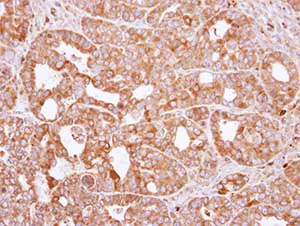 Immunohistochemistry (Formalin/PFA-fixed paraffin-embedded sections) - Anti-RAC2 antibody (AB154711)