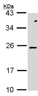 Western blot - Anti-RAC2 antibody (AB154711), expandable thumbnail