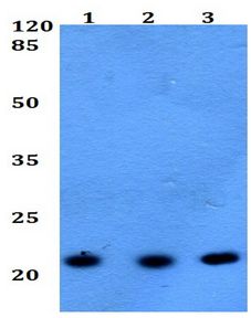 Western blot - Anti-RAC2 antibody (AB191527), expandable thumbnail