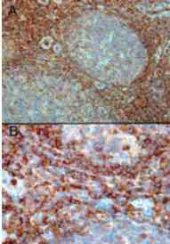 Immunohistochemistry (Formalin/PFA-fixed paraffin-embedded sections) - Anti-RAC2 antibody (AB2244)