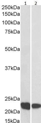 Western blot - Anti-RAC2 antibody (AB2244), expandable thumbnail
