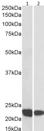 Western blot - Anti-RAC2 antibody (AB2244)