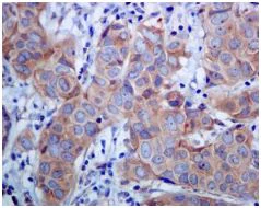 Immunohistochemistry (Formalin/PFA-fixed paraffin-embedded sections) - Anti-RAC3 antibody [EPR6680] (AB129062)