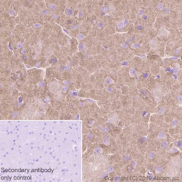 Immunohistochemistry (Formalin/PFA-fixed paraffin-embedded sections) - Anti-RAC3 antibody [EPR6680] - BSA and Azide free (AB248272)