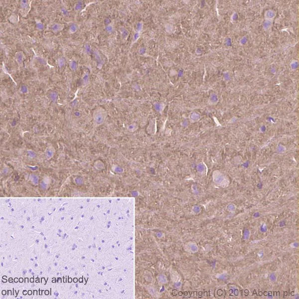 Immunohistochemistry (Formalin/PFA-fixed paraffin-embedded sections) - Anti-RAC3 antibody [EPR6680] - BSA and Azide free (AB248272)