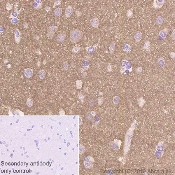 Immunohistochemistry (Formalin/PFA-fixed paraffin-embedded sections) - Anti-RAC3 antibody [EPR6680] - BSA and Azide free (AB248272)