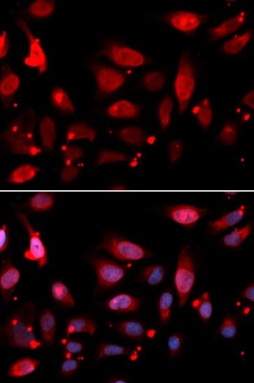 Immunocytochemistry/ Immunofluorescence - Anti-RACGAP1/MGCRACGAP antibody (AB180802)