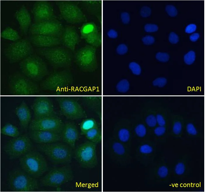 Immunocytochemistry - Anti-RACGAP1/MGCRACGAP antibody (AB2270)