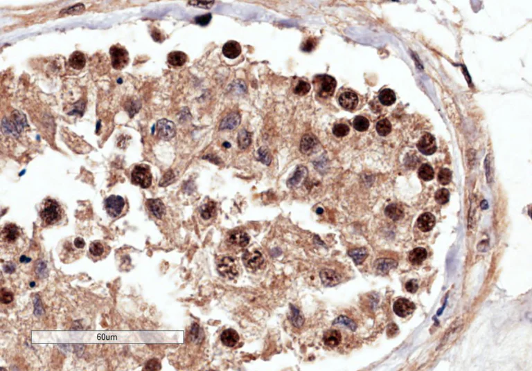 Immunohistochemistry (Formalin/PFA-fixed paraffin-embedded sections) - Anti-RACGAP1/MGCRACGAP antibody (AB2270)