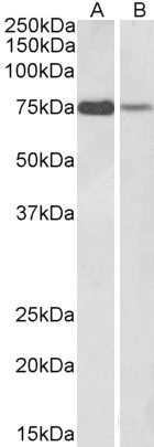Western blot - Anti-RACGAP1/MGCRACGAP antibody (AB2270)