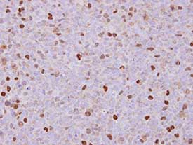 Immunohistochemistry (Formalin/PFA-fixed paraffin-embedded sections) - Anti-RACGAP1/MGCRACGAP antibody (AB97315), expandable thumbnail