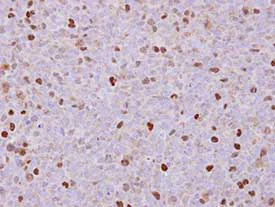 Immunohistochemistry (Formalin/PFA-fixed paraffin-embedded sections) - Anti-RACGAP1/MGCRACGAP antibody (AB97315)