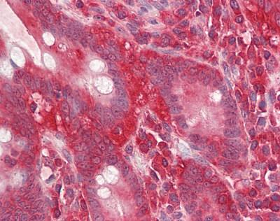 Immunohistochemistry (Formalin/PFA-fixed paraffin-embedded sections) - Anti-RACK1 antibody (AB166796), expandable thumbnail