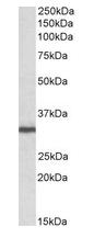 Western blot - Anti-RACK1 antibody (AB166796), expandable thumbnail