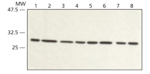 Western blot - Anti-RACK1 antibody (AB62735), expandable thumbnail