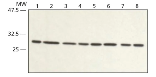 Western blot - Anti-RACK1 antibody (AB62735)