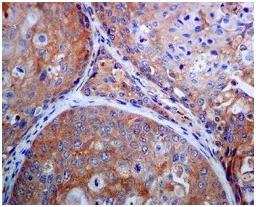 Immunohistochemistry (Formalin/PFA-fixed paraffin-embedded sections) - Anti-RACK1 antibody [EPR7388] (AB129084)