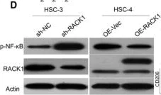 Western blot - Anti-RACK1 antibody [EPR7388] (AB129084)