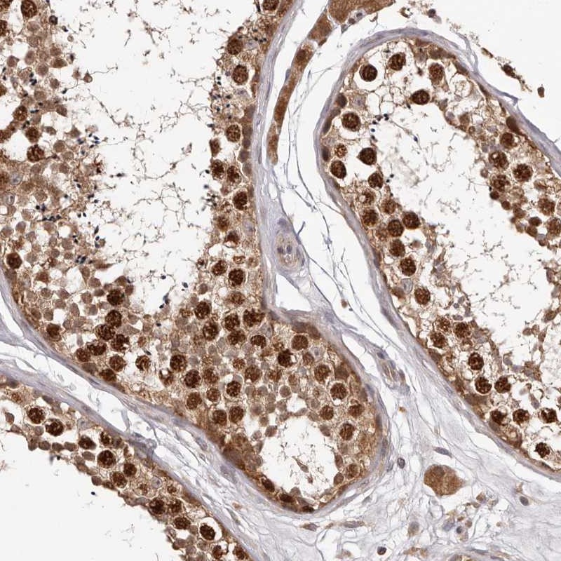 Immunohistochemistry (Formalin/PFA-fixed paraffin-embedded sections) - Anti-RACO-1 antibody (AB272604)