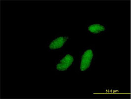 Immunocytochemistry/ Immunofluorescence - Anti-Rad1 antibody (AB168397)