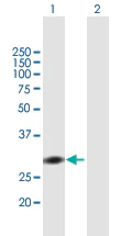 Western blot - Anti-Rad1 antibody (AB168397)
