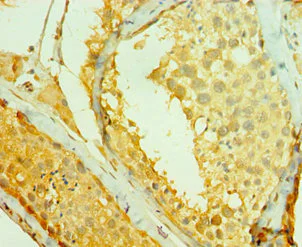 Immunohistochemistry (Formalin/PFA-fixed paraffin-embedded sections) - Anti-Rad1 antibody (AB238584)