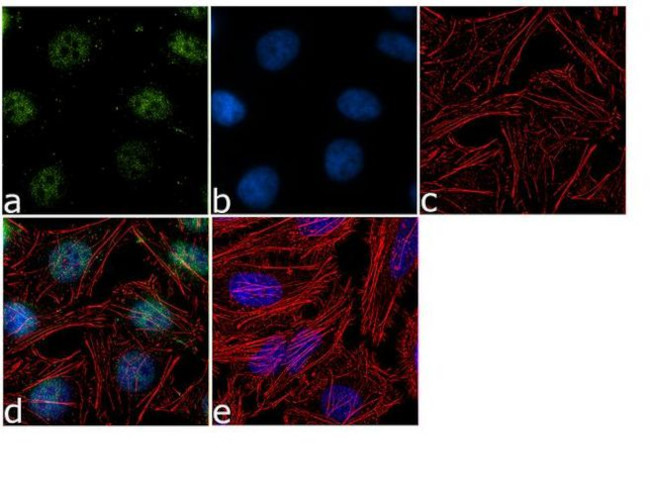 Immunocytochemistry/ Immunofluorescence - Anti-Rad1 Antibody [RP23040152] (AB313458)