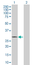 Western blot - Rad1 overexpression 293T lysate (whole cell) (AB94052)