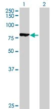 Western blot - Rad17 overexpression 293T lysate (whole cell) (AB94261)