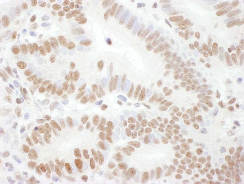 Immunohistochemistry (Formalin/PFA-fixed paraffin-embedded sections) - Anti-Rad17 (phospho S645) antibody (AB3620), expandable thumbnail