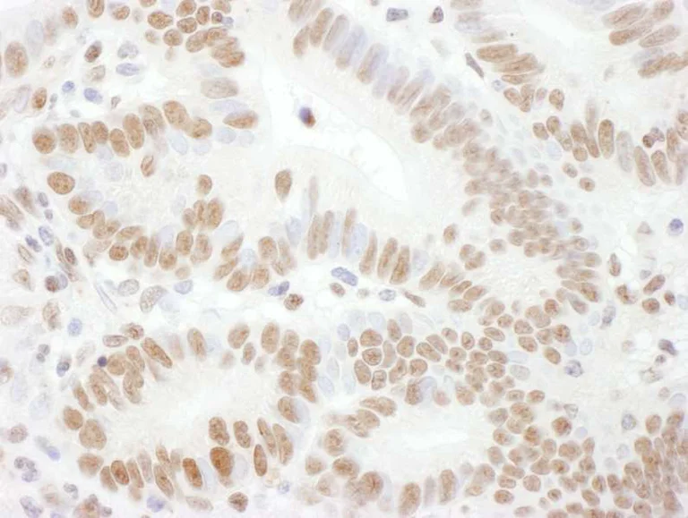 Immunohistochemistry (Formalin/PFA-fixed paraffin-embedded sections) - Anti-Rad17 (phospho S645) antibody (AB3620)