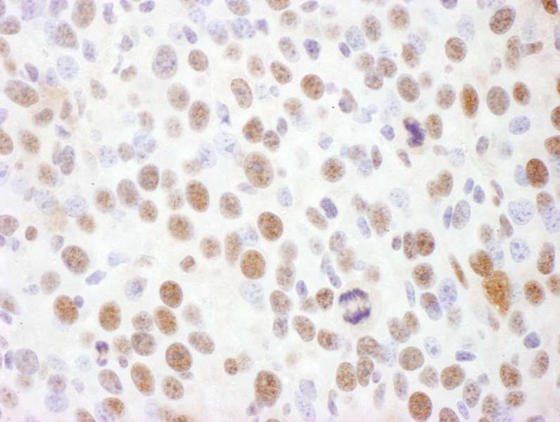 Immunohistochemistry (Formalin/PFA-fixed paraffin-embedded sections) - Anti-Rad17 (phospho S645) antibody (AB3620), expandable thumbnail