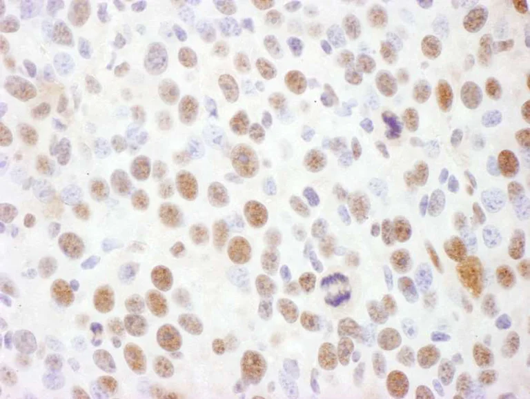 Immunohistochemistry (Formalin/PFA-fixed paraffin-embedded sections) - Anti-Rad17 (phospho S645) antibody (AB3620)