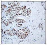 Immunohistochemistry (Formalin/PFA-fixed paraffin-embedded sections) - Anti-Rad17 (phospho S656) antibody [EPR3145] (AB76012)
