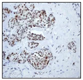 Immunohistochemistry (Formalin/PFA-fixed paraffin-embedded sections) - Anti-Rad17 (phospho S656) antibody [EPR3145] - BSA and Azide free (AB247429)