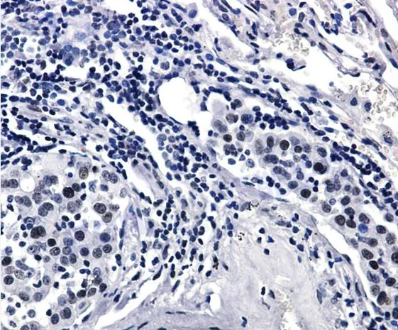 Immunohistochemistry (Formalin/PFA-fixed paraffin-embedded sections) - Anti-Rad17 (phospho S656) antibody [SR2259] (AB326664)
